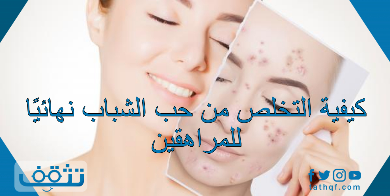 كيفية التخلص من حب الشباب نهائيًا للمراهقين مع بعض النصائح لهم